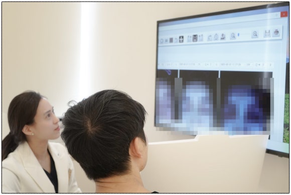 Can Yangcheon-gu dark spots be removed completely and cleanly? image 3