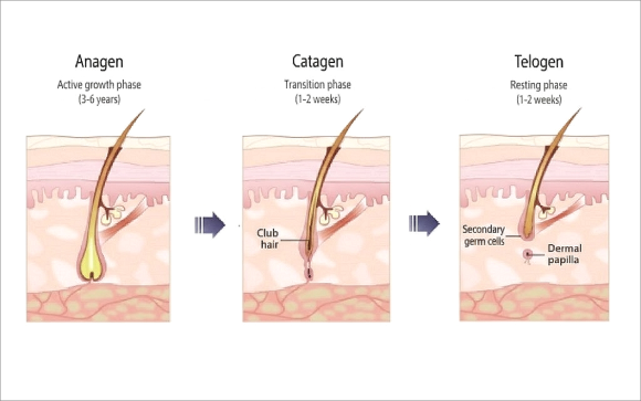 Mokdong Laser Hair Removal: Why Isn’t One Session Enough? image 4