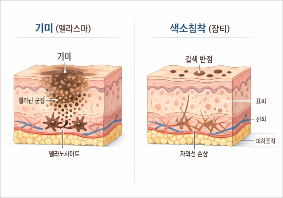 목동피코토닝, 피부 개선을 위해 체크해야 할 포인트 관련 이미지 3