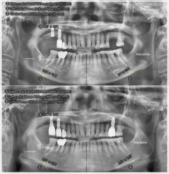 Encore 3D Lifting: What Unexpected Effects Does It Have? A Look Through Research image 7