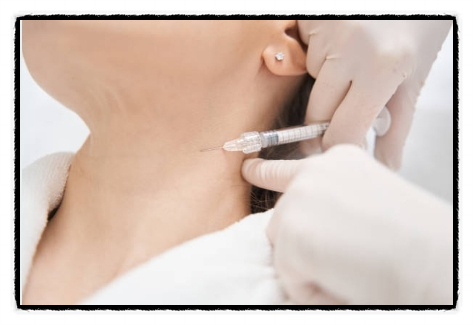 Wondering About How Long Neck Wrinkle Fillers Last and Their Effects? <Written by a Doctor> image 4