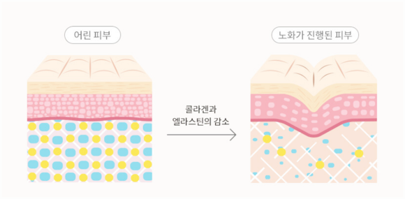 목동역실리프팅 윤곽정리가 필요하다면 관련 이미지 2