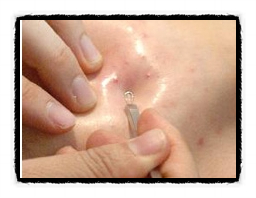 Seoul Aqua Peel: It Can Be Helpful When This Is Bothering You image 10