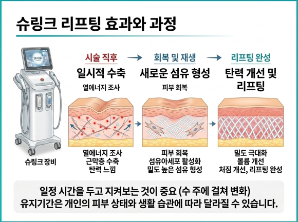 Mok-dong Shurink: What Treatment Criteria Matter More Than Results and Shot Count? image 4