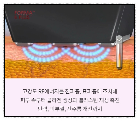 A Complete Analysis of the Differences Between the Two Versions of InMode in Mok-dong <Written by a Doctor> image 4
