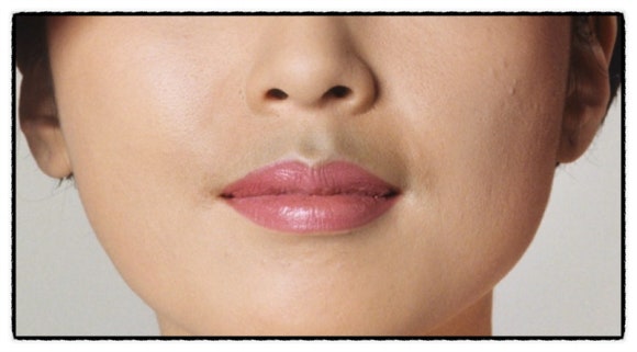Can Upper-Lip Hair Be Cleanly Removed with Mokdong Hair Removal? <Doctor's Answer> image 6