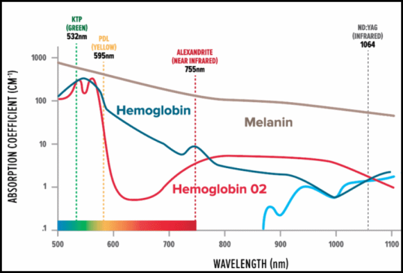 Why Does Mokdong Laser Hair Removal Require Multiple Sessions? image 2