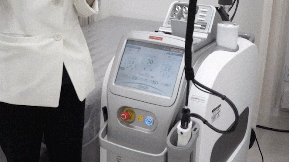 Key Points for Reducing Recurrence After Mung-dong Melasma Removal image 5