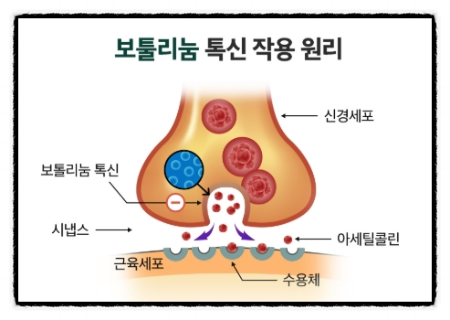 A Complete Overview of the Basic Concepts You Should Know Before an O목교역 Botox Procedure image 3