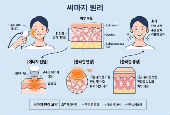 For Those Worried About Skin Texture That Doesn’t Feel the Same as Before with MOKDONG Thermage image 2