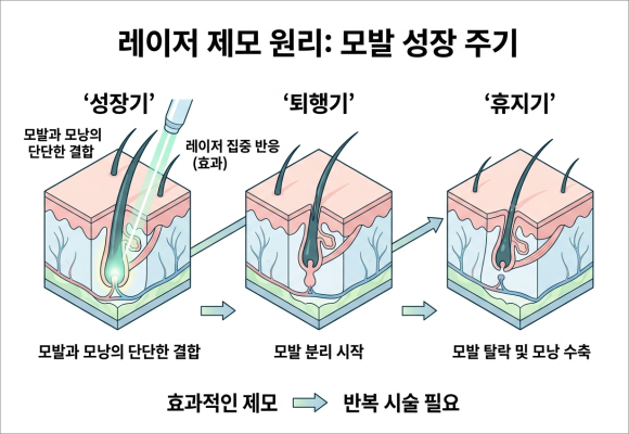 If You're a Beginner 고민하고 있다면 for Your First Start with Mokdong Underarm Hair Removal image 3