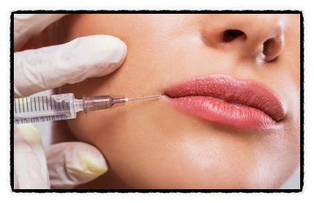 Precautions When Getting Filler for the Corners of the Mouth in Mok-dong <Written by a Doctor> image 2