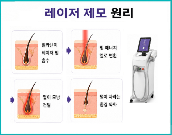 Mokdong Station Laser Hair Removal: Why Is It Also Possible for Sensitive Skin? image 3