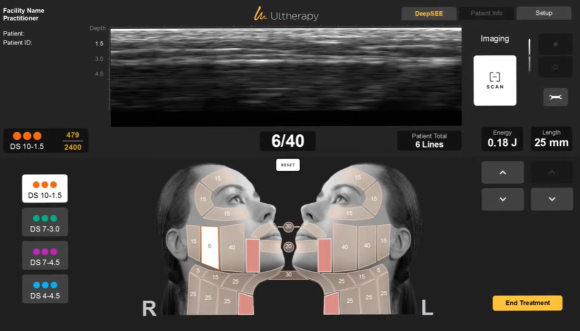 Why Mok-dong Ulthera Is the Standard for Skin Tightening Procedures image 3