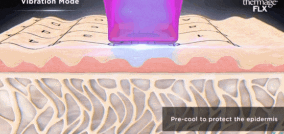 Would It Be Better Than Ulthera and Thermage in Mok-dong? <Complete Summary> image 8