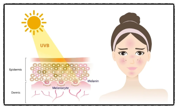 Can Yangcheon-gu dark spots be removed completely and cleanly? image 4