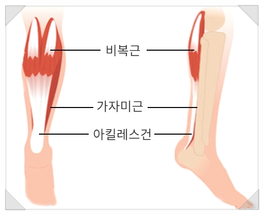 목동역보톡스 맞아도 종아리 굵어 보이는 이유 <필독> 관련 이미지 3
