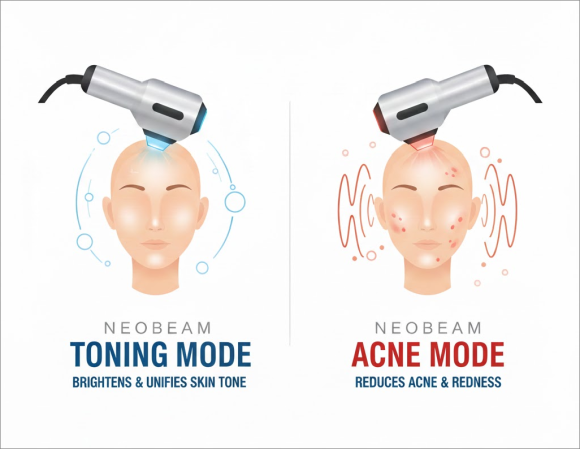 Yangcheon-gu Acne Treatment: Don’t Just Squeeze It image 5