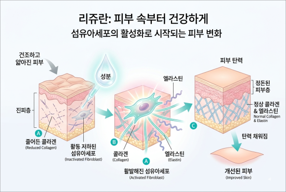 목동리쥬란 시술 전·후 관리 포인트 확인하세요 관련 이미지 3