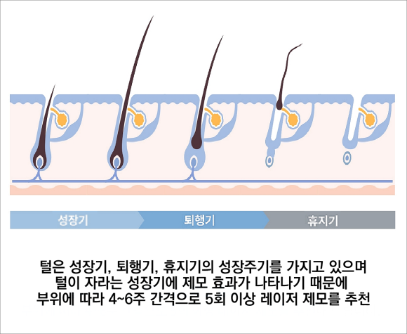 Why Laser Hair Removal in Yangcheon-gu Can’t Be Done All at Once and the Points You Should Check image 4