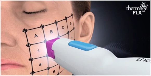 Would It Be Better Than Ulthera and Thermage in Mok-dong? <Complete Summary> image 4