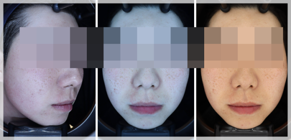 Omokgyo Dermatology Clinic, If Numerous Blemishes Make Your Skin Tone Look Dull? (Department: Dermatology) image 6