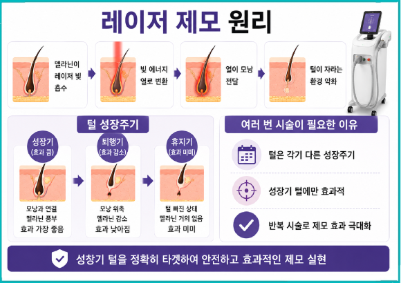 오목교제모, 정말 털이 안날까요? 효과를 좌우하는 핵심 기준 관련 이미지 2