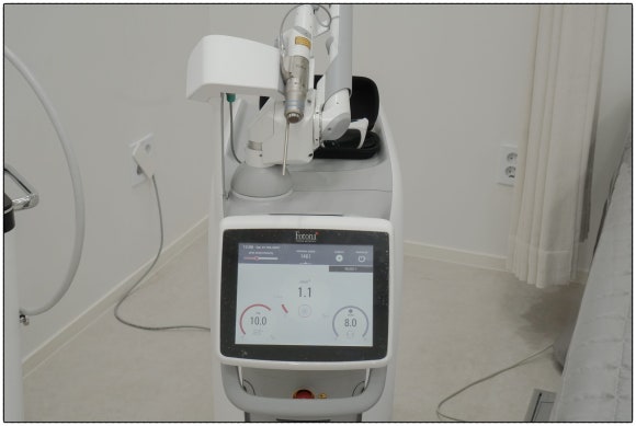 How Should You Choose a Laser for Melasma Treatment in Mok-dong? image 7