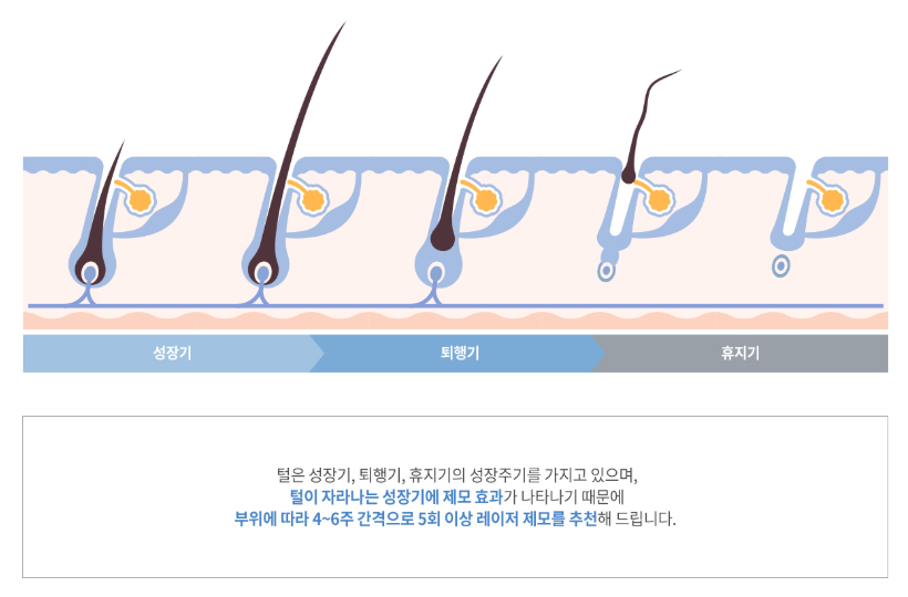 Omokgyo Laser Hair Removal: Why It Works Better Than Waxing or Regular Hair Removal image 5