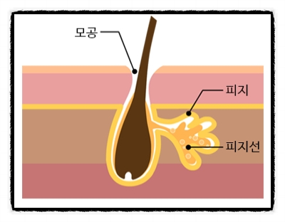 양천구여드름 발생 원인부터 맞춤형 치료법까지 총정리 관련 이미지 3