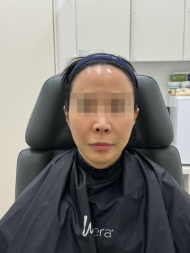 목동역실리프팅 윤곽정리가 필요하다면 관련 이미지 4