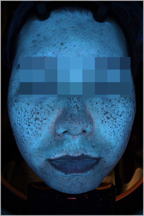 Omokgyo Dermatology Clinic, If Numerous Blemishes Make Your Skin Tone Look Dull? (Department: Dermatology) image 5