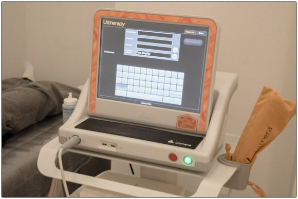 Ultherapy in Mokdong: Ultrasound Lifting to Care for a Collapsed Face image 5
