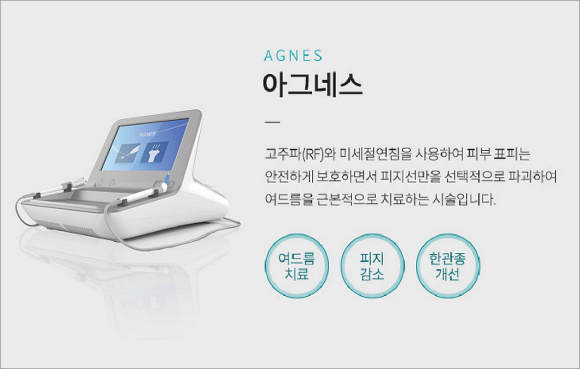 Key Points You Must Keep in Mind During Acne Treatment in Yangcheon-gu image 3