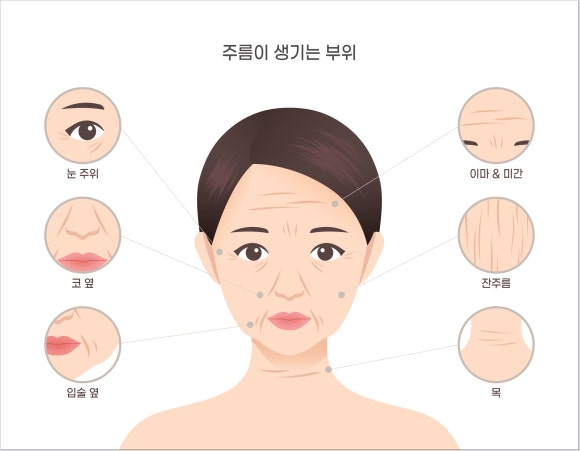 Omokgyo Filler: If wrinkles make you feel self-conscious when smiling image 4