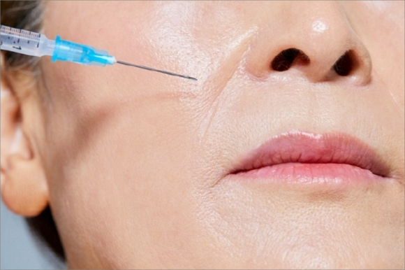 UN&I Mokdong Filler, Before the Procedure image 4