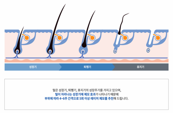 Mokdong Laser Hair Removal: What If Frequent Shaving and Waxing Have Made Your Skin Sensitive? image 3