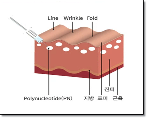 Mokdong Rejuran: Features by Type, Depending on Your Skin Condition image 4
