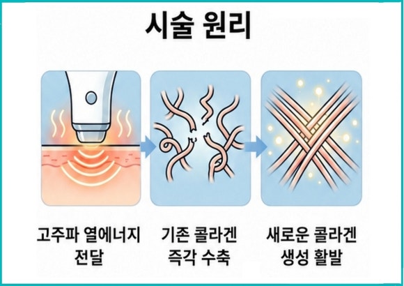 Mokdong Oligio: Worried That Your Skin’s Firmness Will Drop Quickly? image 2