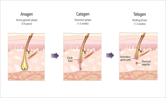 What You Should Definitely Know Before Getting Omokgyo Laser Hair Removal image 2