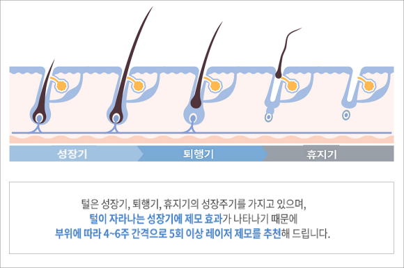 Yangcheon-gu Laser Hair Removal: How Can You Get It Cleanly Without Dark Marks? image 4