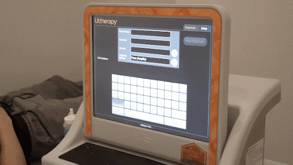 Ultherapy in Mokdong: Ultrasound Lifting to Care for a Collapsed Face image 2