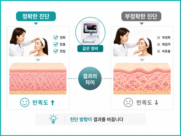 Mokdong Thermage: Principles and Key Points to Know Before the Procedure image 4