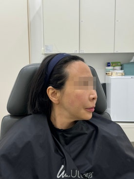 목동역실리프팅 윤곽정리가 필요하다면 관련 이미지 7