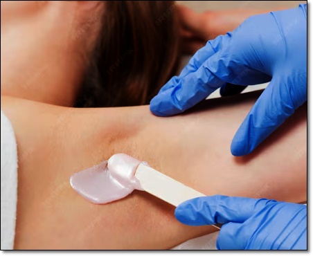 Mok-dong Underarm Hair Removal, A Complete Summary of the Pros and Cons by Hair Removal Type image 3