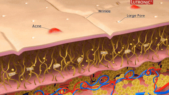 Omokgyo Dermatology Clinic, If Numerous Blemishes Make Your Skin Tone Look Dull? (Department: Dermatology) image 3