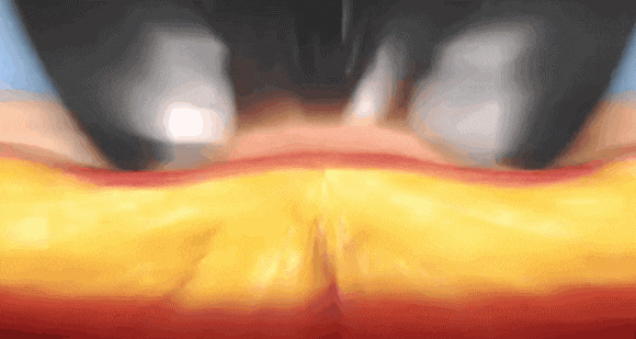 Yangcheon-gu InMode: What If You’re Worried About Both Facial Firmness and Fat? image 4