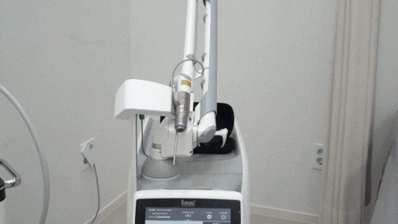 Photona StarWalker: Does it really resolve “blemishes, blood vessels, and pores” all at once? image 2