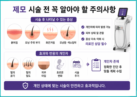 오목교제모, 정말 털이 안날까요? 효과를 좌우하는 핵심 기준 관련 이미지 6
