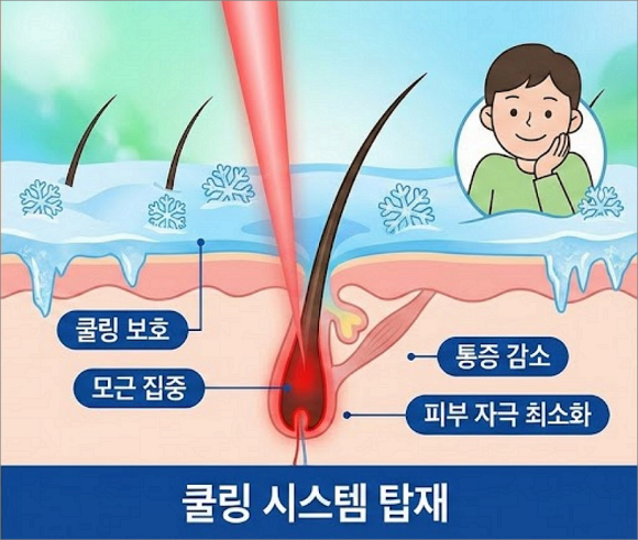 Mokdong Laser Hair Removal: Why Isn’t One Session Enough? image 3